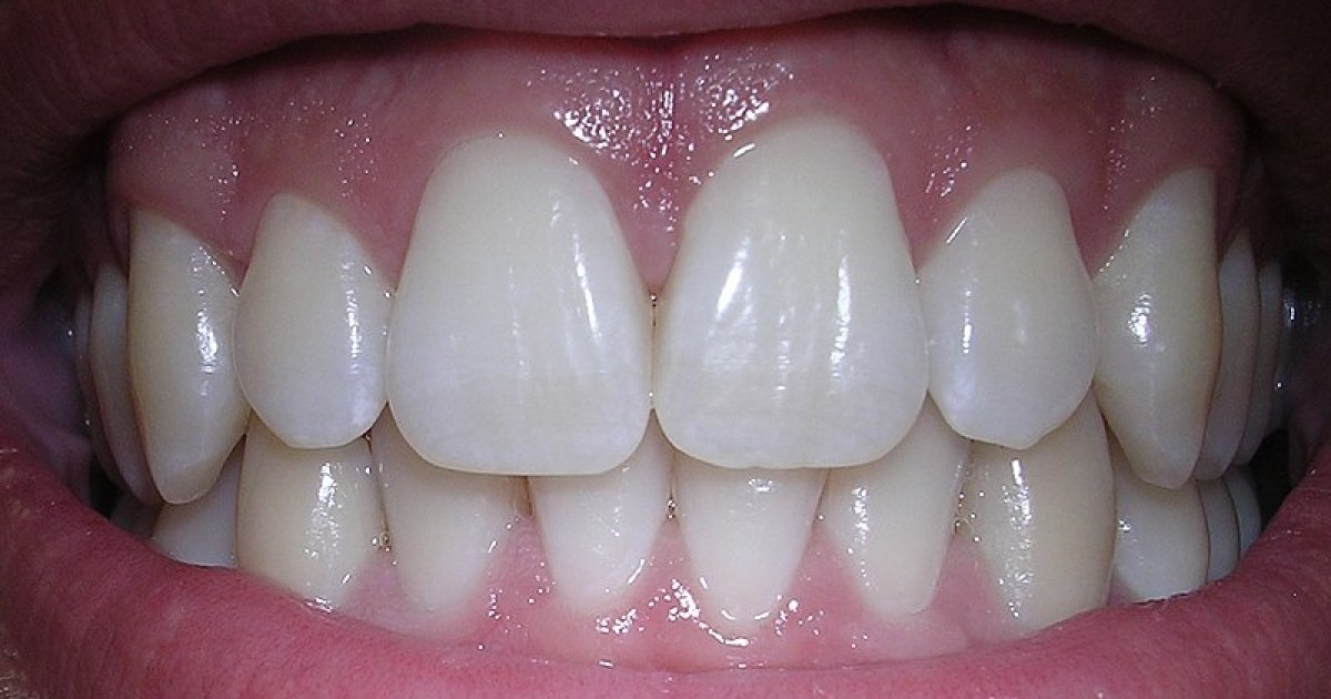 Стыдно идти к стоматологу: причины, последствия и как с этим справиться